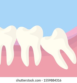 The figure of eight tooth grows incorrectly, the wisdom tooth grows crookedly