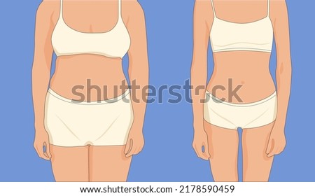 Figure of a woman befor and after from the front. Vector illustration.