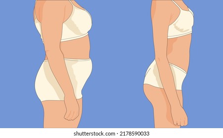 Figure of a woman befor and after from the side. Vector illustration.