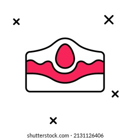 Filled outline Acne icon isolated on white background. Inflamed pimple on the skin. The sebum in the clogged pore promotes the growth of a bacteria.  Vector