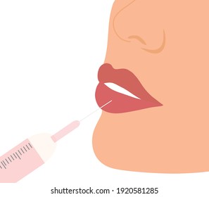 Concepto de inyección de relleno. La jeringa sérica inyecta un llenado al labio de la ilustración vectorial de la mujer. Concepto de tratamiento estético estético de belleza