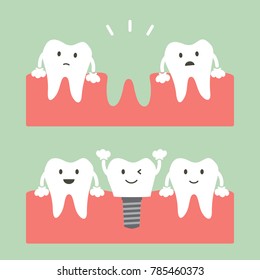 filling dental implant with crown, before and after - tooth cartoon vector flat style cute character for design