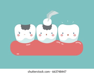 Filling tooth ,teeth and tooth concept of dental 