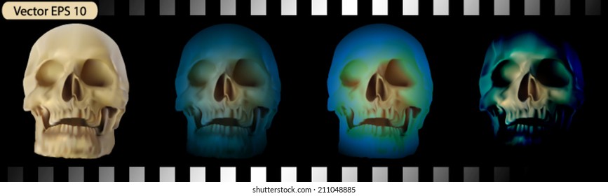 Film slide of skull head.