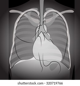 film x-rays of chest for medical learning and study concept. Easily understand radiology of bony structure.