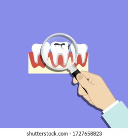 Finding problem teeth, caries, dirty enamel. Magnifying glass in hand. Tooth with caries icon on isolated background. EPS 10 vector.