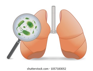 Erforschung des Virus in der menschlichen Lunge mit einer Vergrößerung. Medizinische Illustration über Lungenerkrankungen.