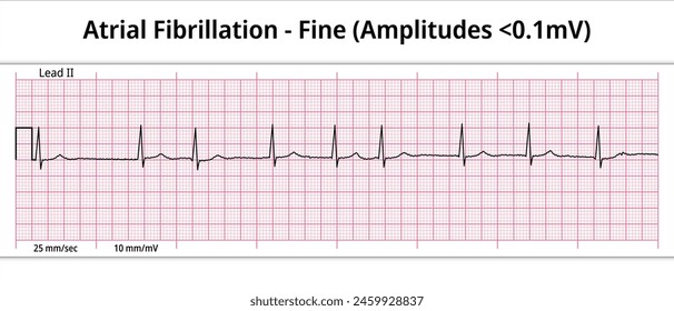 Fibrilación auricular fina - 8 Second ECG Paper - Vector de electrocardiografía