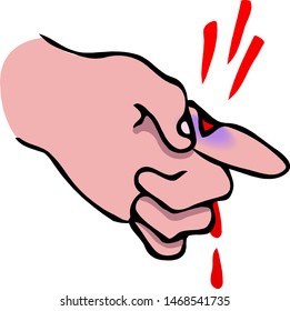 Finger stab wound. The finger is bleeding.