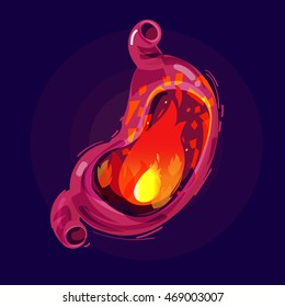 Fire In Human Stomach. Sick Stomach Acid In The Stomach - Vector Illustration