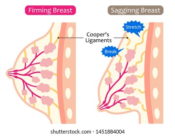 Beautiful Saggy Breasts