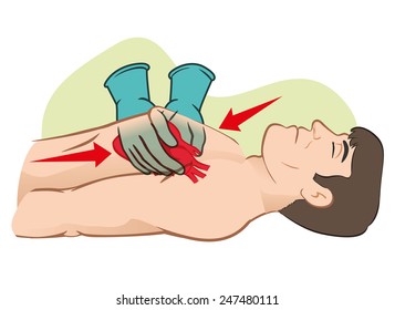 First Aid cardiac resuscitation (CPR), open heart massage. For resuscitation. Ideal for training materials, catalogs and institutional