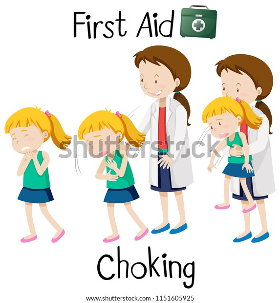 First Aid Chocking Illustration Stock Vector (Royalty Free) 1151605925 ...