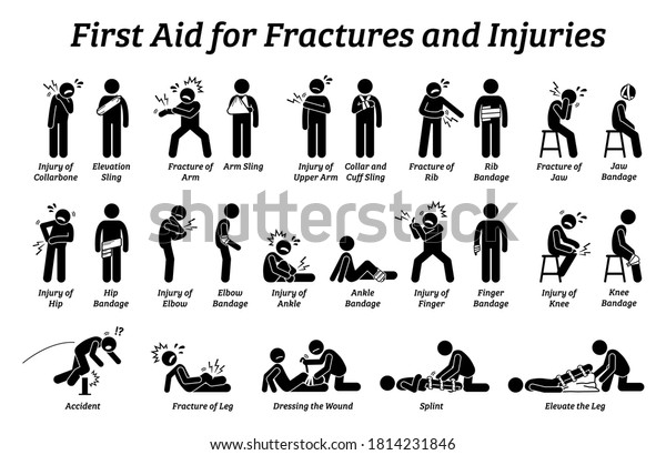 別の身体部品のスティックの図アイコンで 骨折やけがに対する応急処置 骨折や痛みの治療方法を示すスリング 包帯 仰角のベクターイラスト のベクター画像素材 ロイヤリティフリー