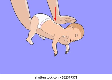First aid for newborns