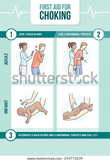 First Aid Procedure Choking Heimlich Maneuver Stock Vector Royalty Free 254773639 First Aid Procedure Choking Heimlich Maneuver Stock Vector Royalty Free 254773639