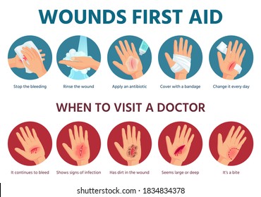 First aid for wound on skin. Treatment procedure for bleeding cut. Bandage on injured palm. Emergency situation safety infographic in vector. Illustration aid skin, injury and trauma