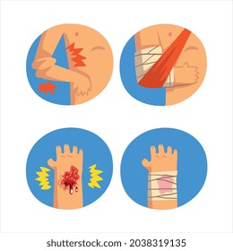 First Aid for Wounded Arm and Hand in Blue Circle Vector Set