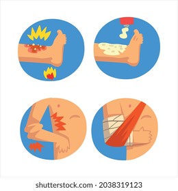 Erste Hilfe für verwundete Arme und Leine in blauem Circle Vector Set