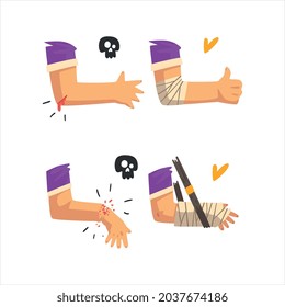 First Aid For Wounded Bloody Elbow And Arm Fracture Vector Set