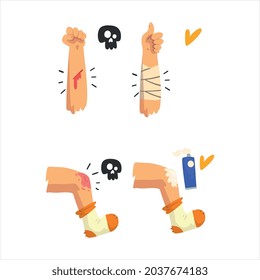 First Aid for Wounded Leg and Arm Vector Set