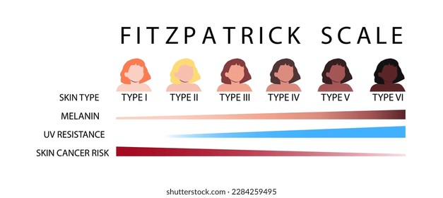 Fitzpatrick scale. Skin types infographic with female faceless characters. Human phototypes. Melanin, UV resistance and skin cancer risk diagrams. Vector illustration