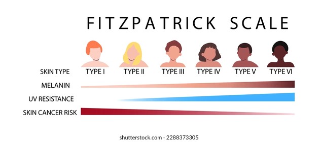 Fitzpatrick scale. Skin types infographic with male and female faceless characters. Human phototypes. Melanin, UV resistance, skin cancer risk diagrams. Vector illustration