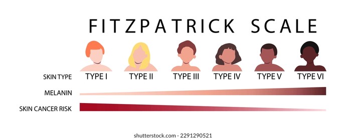 Fitzpatrick scale. Skin types infographic with male and female faceless characters. Human phototypes. Dependence of melanin and skin cancer risk. Vector illustration