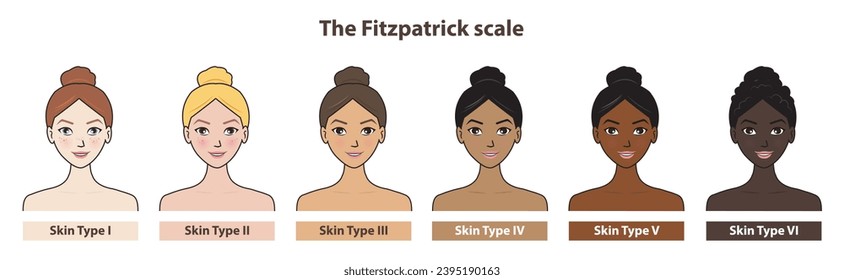 Fitzpatrick skin tone phototype with cute cartoon character vector isolated on white background. Diagram of ethnicity skin tone scale phototype melanin and hair color melanin. The Fitzpatrick scale.