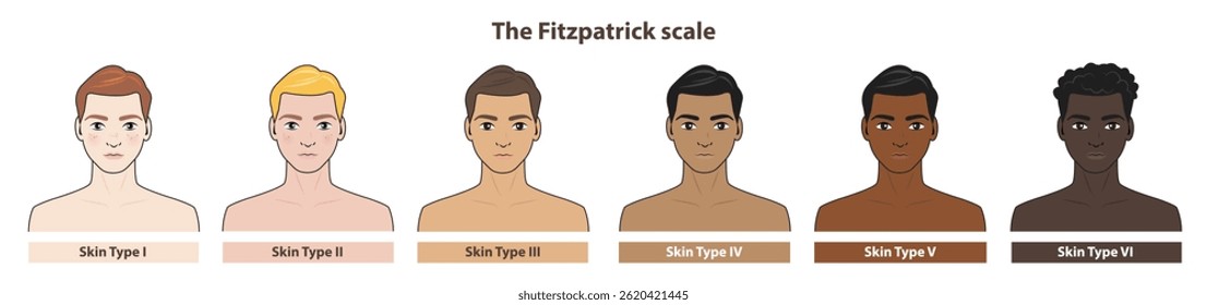 O tom de pele Fitzpatrick fototipo com ilustração de personagem de desenhos animados homens sobre fundo branco. Diagrama da escala de tom de pele etnia fototipo melanina e cor de cabelo melanina. A escala Fitzpatrick.