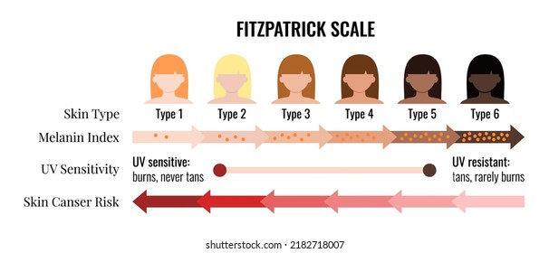 Fitzpatrick skin tone scale phototype melanin index with female avatar. Chart element with type I II III IV V IV human skin hair color melanin content in the cell cancer risk flat vector illustration