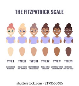 Fitzpatrick Skin Type Classification Scale Shown In Women. Human Skin Tone Pigmentation Diversity Infographics. Six Phototypes From Fair To Dark Complexion Variations. Vector Cartoon Illustration.