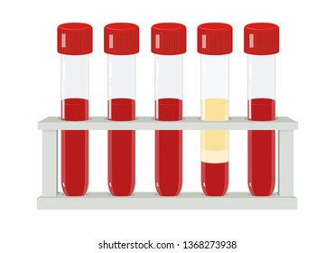Five blood test tubes in rack, medical vector illustration 