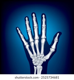 Five finger bones of a man on a blue background.Bones of a human hand on a blue background. Inflammation of the joints. Medical poster. Vector illustration