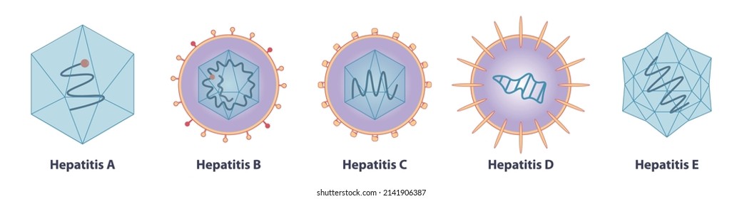 Five main types of viruses cause hepatitis: hepatitisviruses A (HAV), B (HBV), C (HCV), D, (HDV) and E (HEV)
