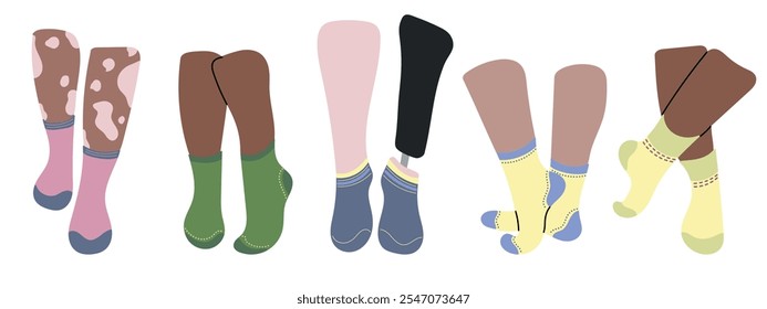 Five pairs of socks design on legs. Concept diversity white, black color skin, vitiligo, inclusive person with prosthetic leg. Blue, pink, green, yellow socks. Low cut, ankle, knee high, over the calf