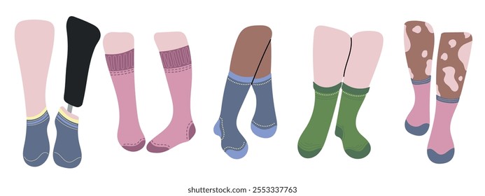 Cinco pares de calcetines de diseño en las piernas. Concepto diversidad piel de color blanco, negro, vitiligo, persona inclusiva con pierna protésica. Calcetines azules, rosas, verdes, amarillos. Corte bajo, tobillo, rodilla alto, sobre la pantorrilla