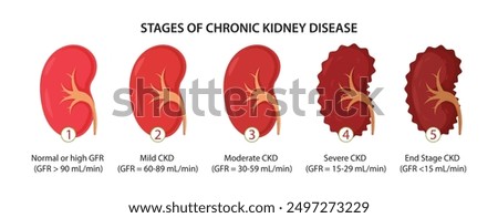 five stage kidney disease vector design isolated white background