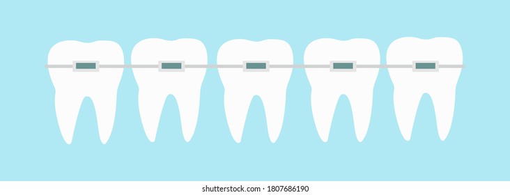 Five teeth with dental braces line on blue background vector illustration. Orthodontic treatment