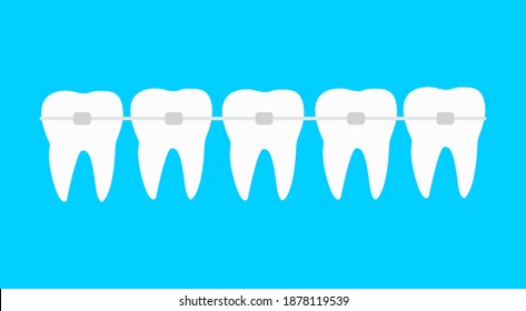 Five teeth with dental braces on blue background vector illustration. Dental tooth care, orthodontic treatment concept