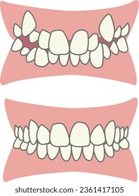 Fix Vampire tooth and double tooth vector illustration