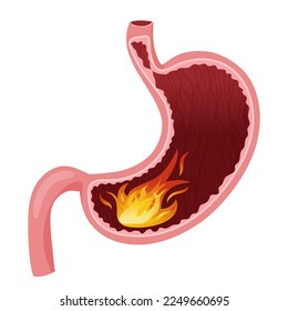 Flame in human stomach. Vector illustration, cartoon style, white background
