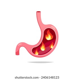 Flame in human stomach vector isolated on white background.
