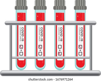 Flasks with blood, coronavirus test