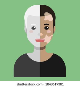 Ilustración vectorial colorida de dibujos animados planos, que muestra las características de la pigmentación de la gente. El hombre es medio albino, medio vitiligo. 16 de noviembre - Día Internacional de la Tolerancia