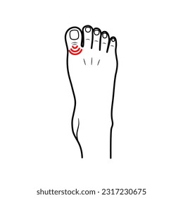 Flat design of health pain and body injury in the toe area, feeling pain in the feet, toes. Vector illustration EPS 10.