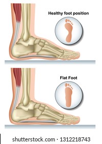 Flat foot medical vector illustration on white background