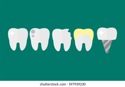 Flat health care dentist tooth implants research medical healthcare concept and medicine instrument hygiene stomatology engineering vector illustration.