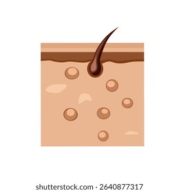 flat illustration of human skin layers 