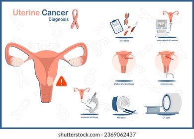 Ilustración vectorial médica plana de cáncer uterino.Diagnóstico de cáncer uterino y uterino.análisis de sangre, tomografía por tomografía, ecografía, biopsia endometrial, histeroscopia, dilatación y curetaje.